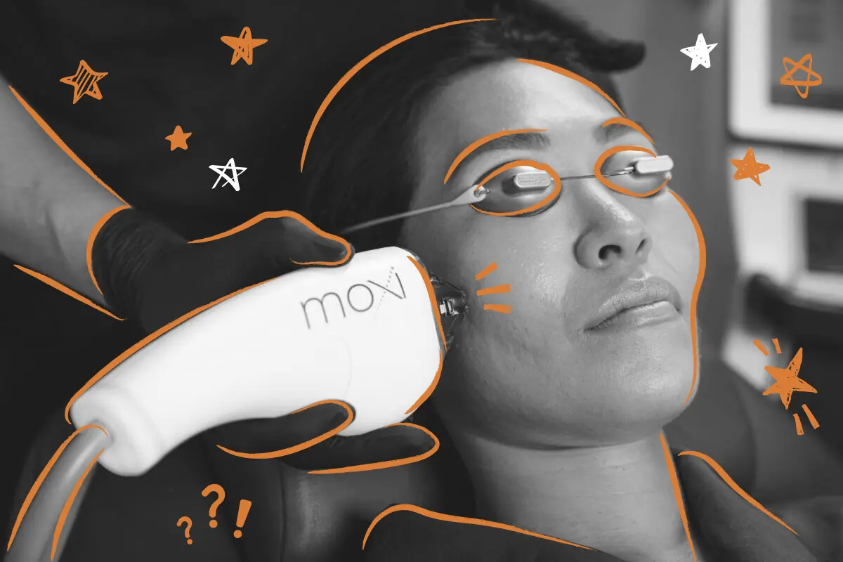 The-Moxi-laser